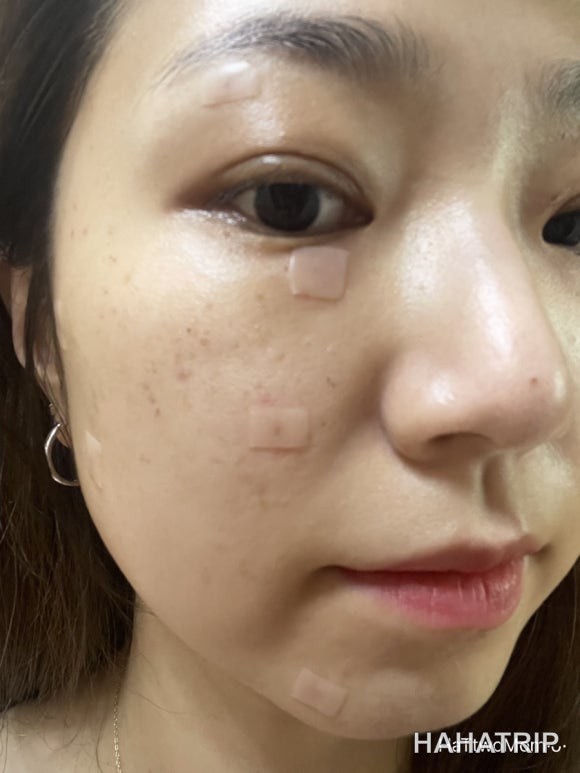 피부 잡티 제거 관련 사진 - HAHATRIP 여행 가이드 피부 잡티 제거 이미지 11 - HAHATRIP